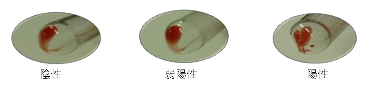 陰性弱陰性陽性