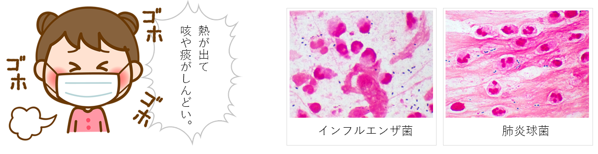 熱が出て 咳や痰がしんどい。