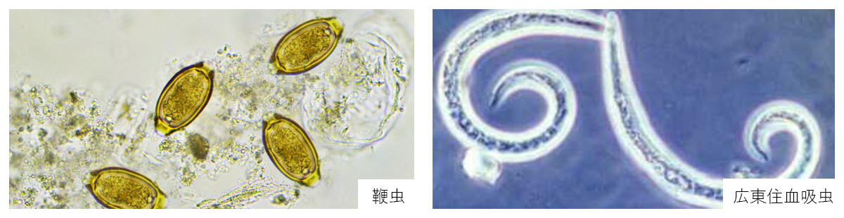 鞭虫/広東住血吸虫